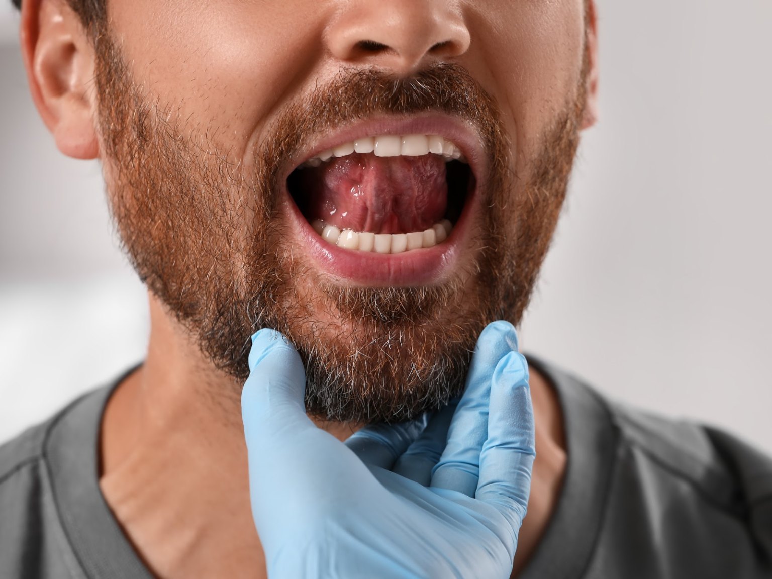 A gloved hand steadying a man's jaw as he lifts his tongue for an oral exam