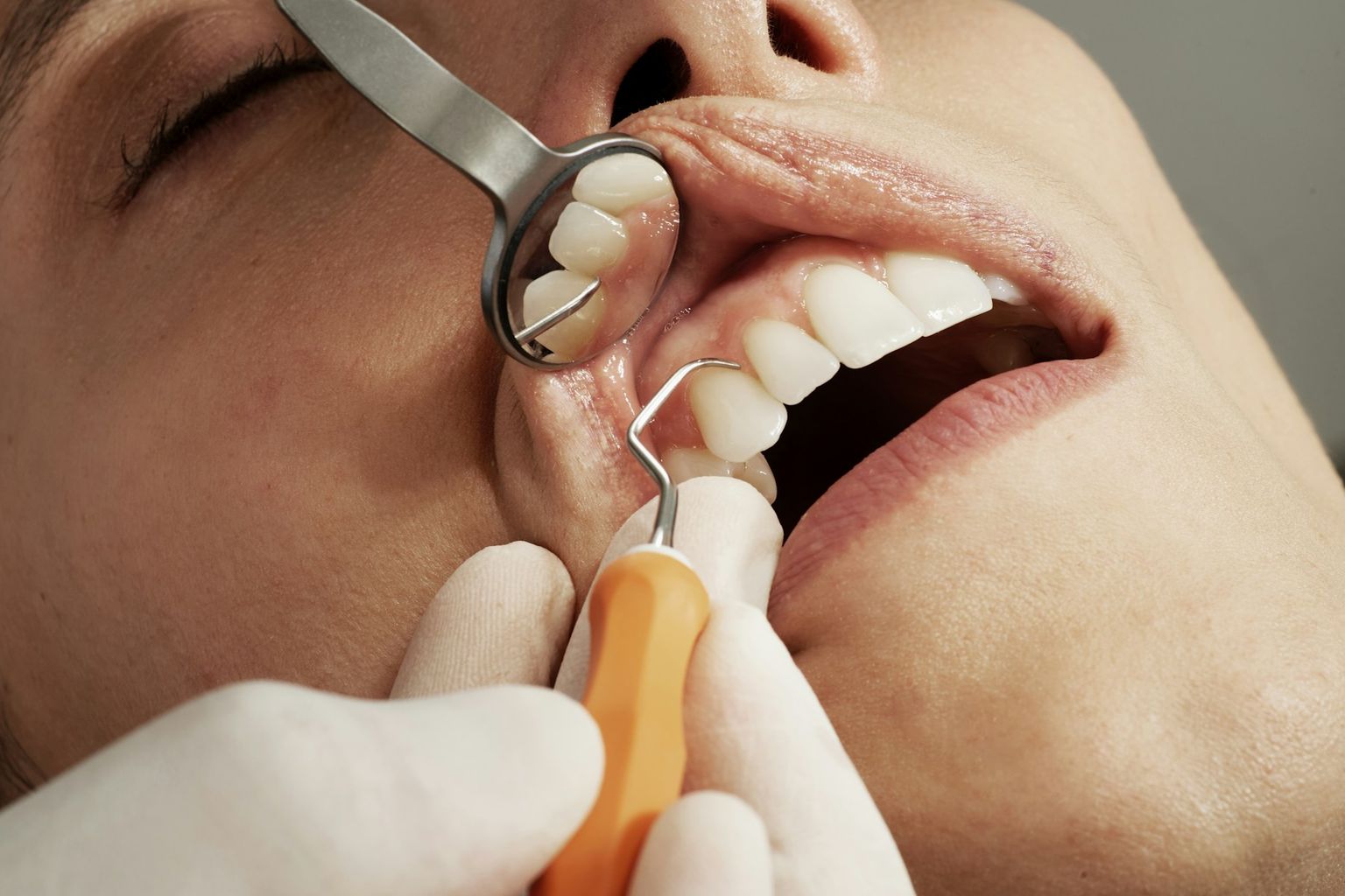 A dental examination with mirror and probe