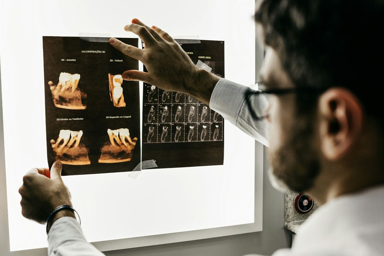 A dentist reading a set of x-rays on a light box
