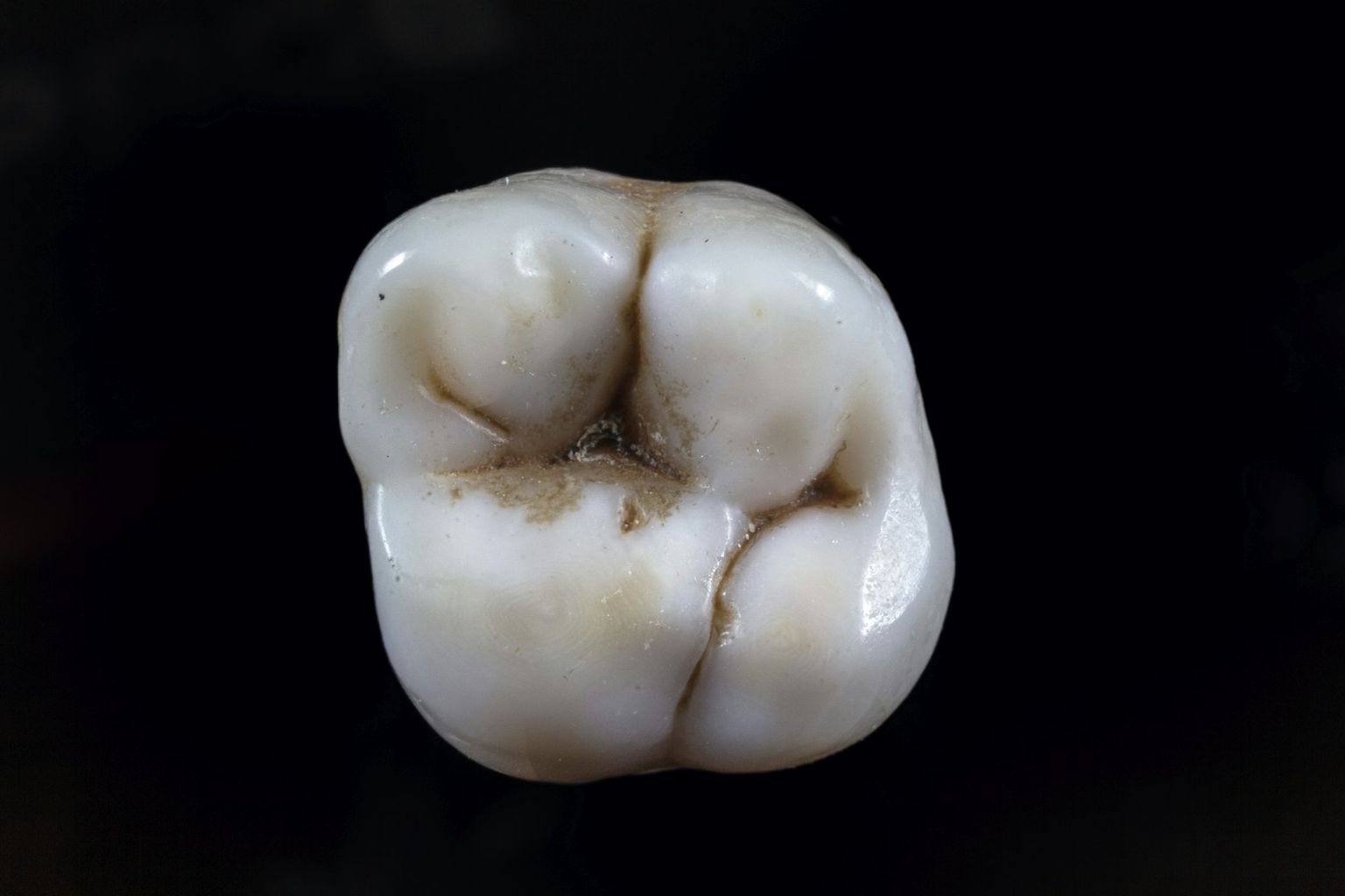 The chewing surface of a molar, with its grooves