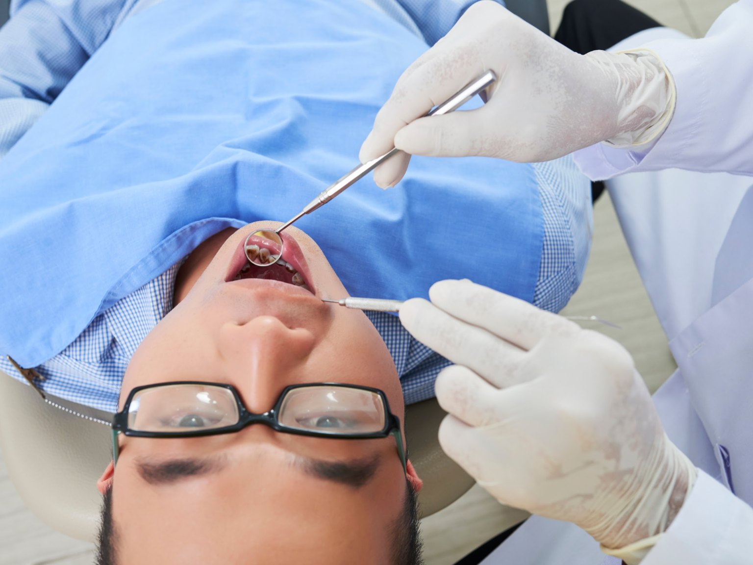 An overhead view of a dentist using a mouth mirror to check the back teeth of a patient in glasses